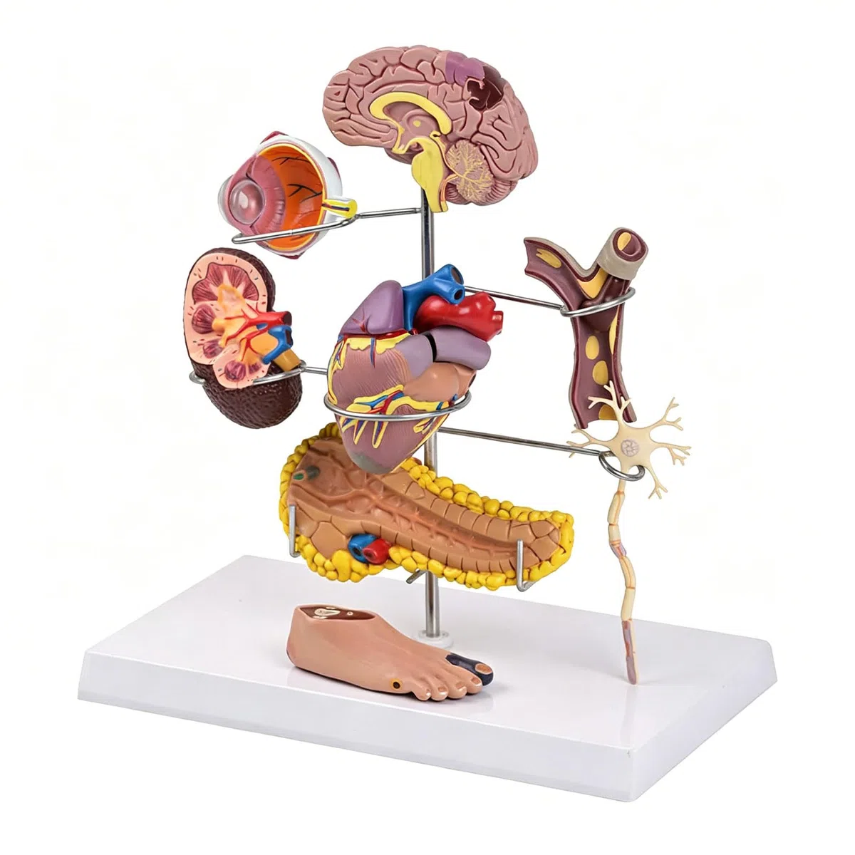Modèle réaliste en PVC pour diabète hypertension, diabète
