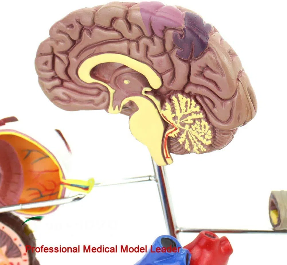 Diabète Enseignement Médical Modèle D'Affichage Sciences De L'Éducation Pathologie Expliquer Une Bonne Aide