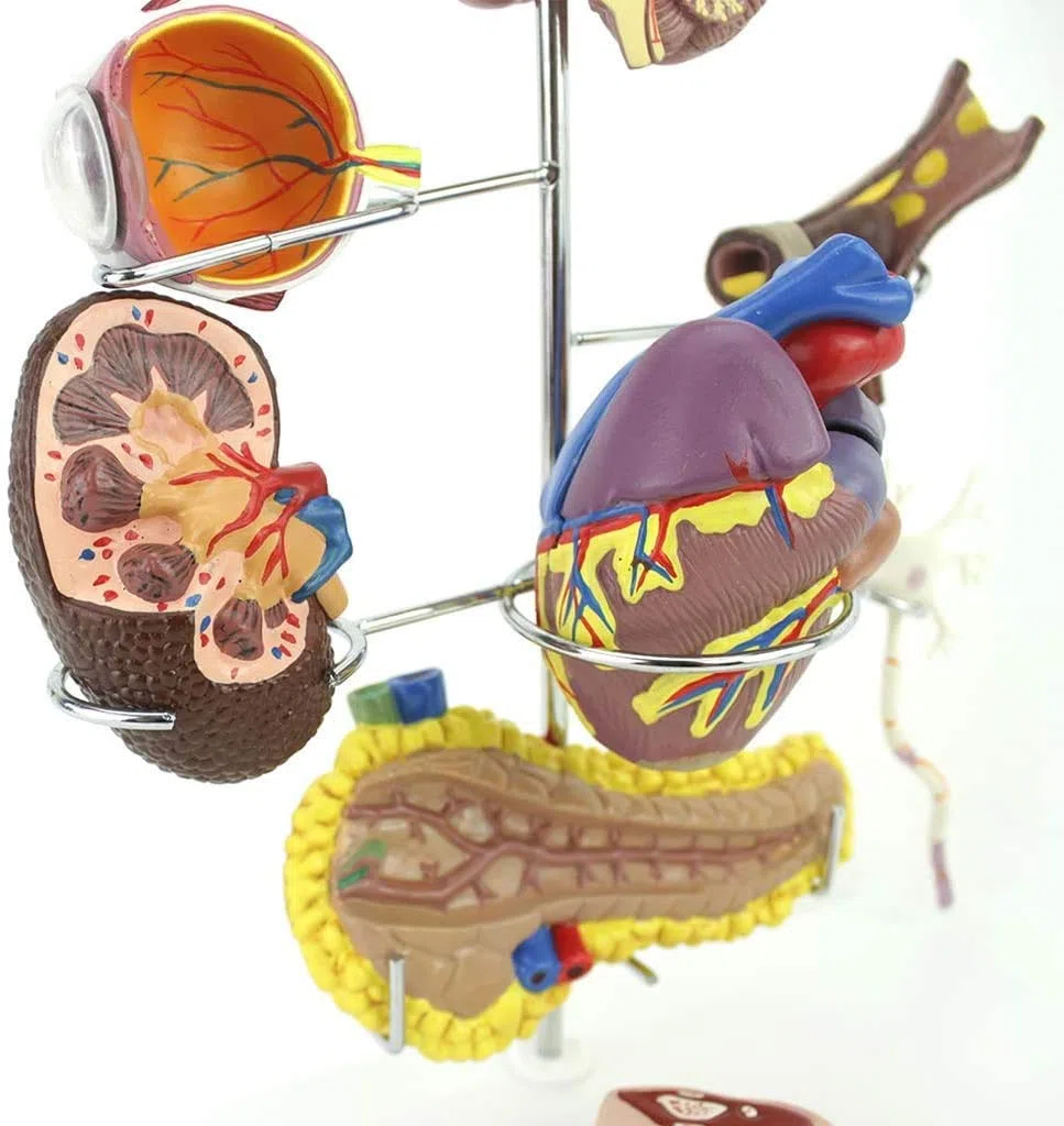 Modèle D'Organes Diabète - Médical Anatomical Cérébrale Diabète Complication Cardiaque Chirurgie du Pancréas Neuron - pour Aide À La Formation Pédagogique des Étudiants