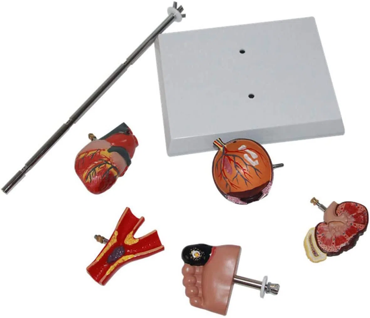 Modèle De Diabète Organ Organe Médical Anatomique Modèle De Diabète Anatomique Modèles D'anatomie Humaine pour Une Aide À La Formation Pédagogique