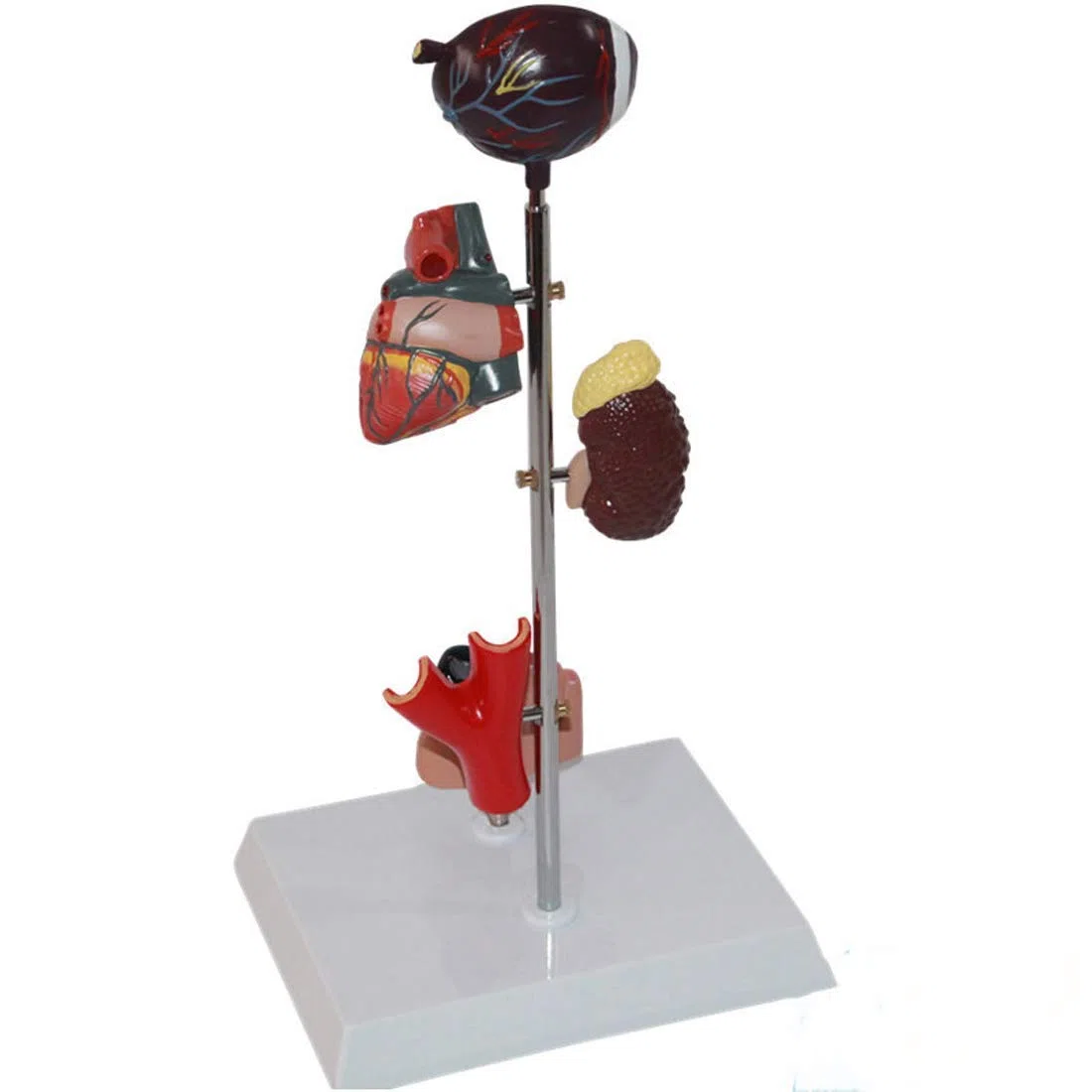 ERNZI Modèle Éducatif Modèle Organe De Diabète - Modèle Médical Anatomique De Diabète - Modèle Anatomique Organe Amovible Modèles Scientifiques Anatomie Humaine - pour Aide À La Formation