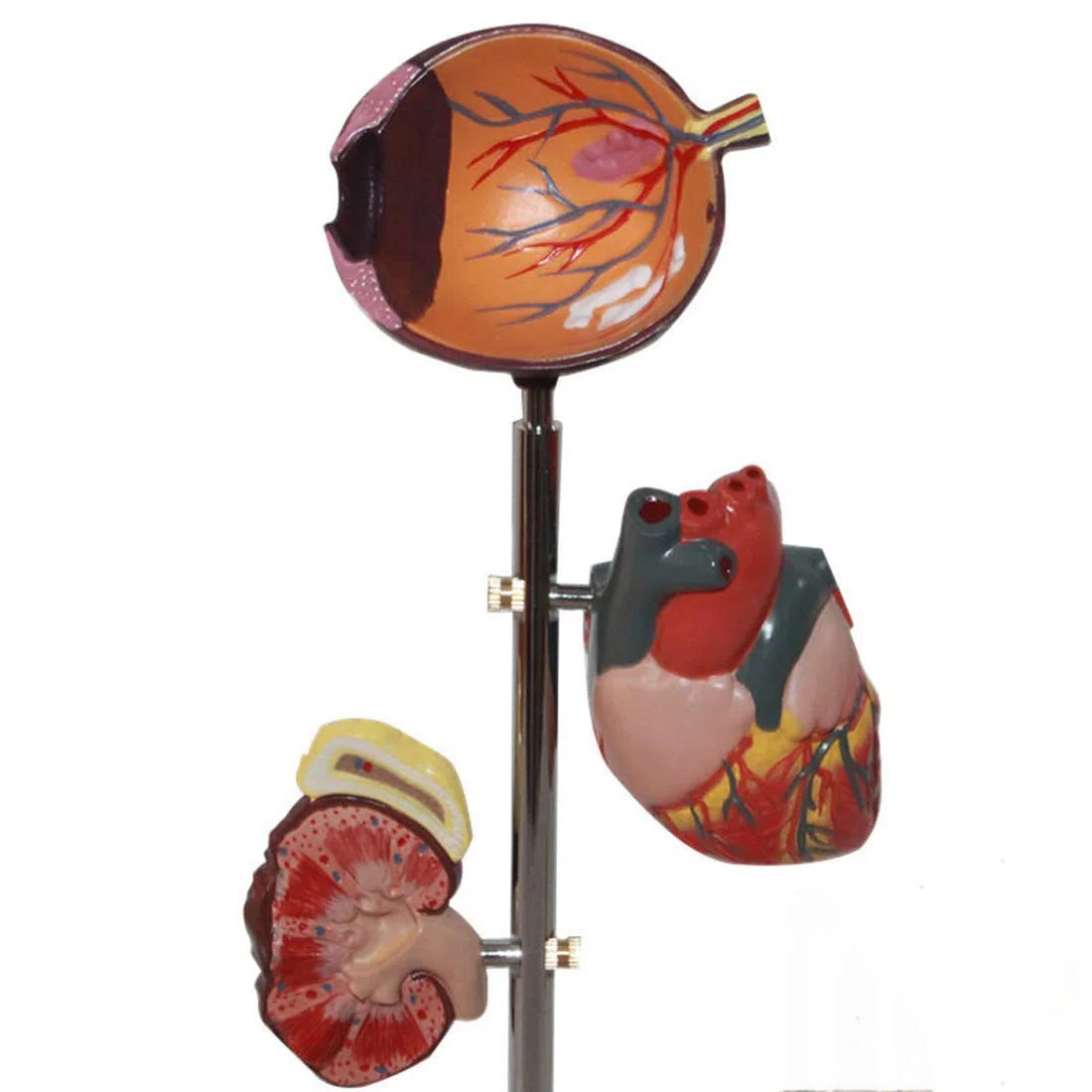 ERNZI Modèle Éducatif Modèle Organe De Diabète - Modèle Médical Anatomique De Diabète - Modèle Anatomique Organe Amovible Modèles Scientifiques Anatomie Humaine - pour Aide À La Formation