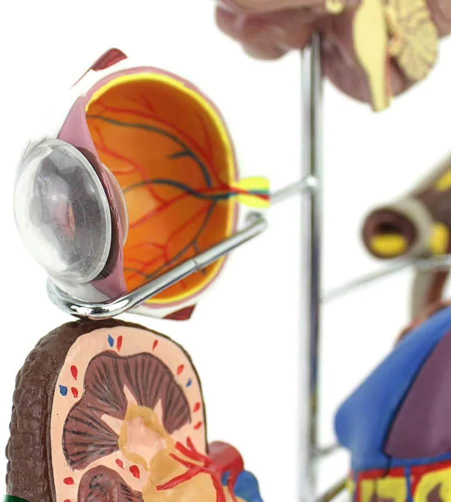 Diabète Enseignement Médical Modèle D'Affichage Sciences De L'Éducation Pathologie Expliquer Une Bonne Aide