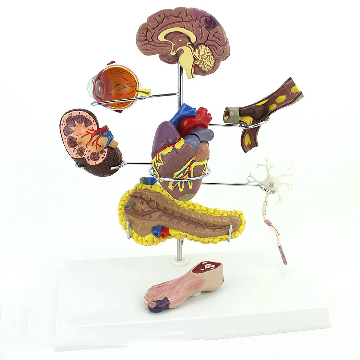 Modèle De Diabète De Médecine Humaine, Complications du Diabète Montrent Le Cerveau, Le Cœur, Le Pancréas, Le Neurone, Le Pied, Utilisé pour l'enseignement Médical